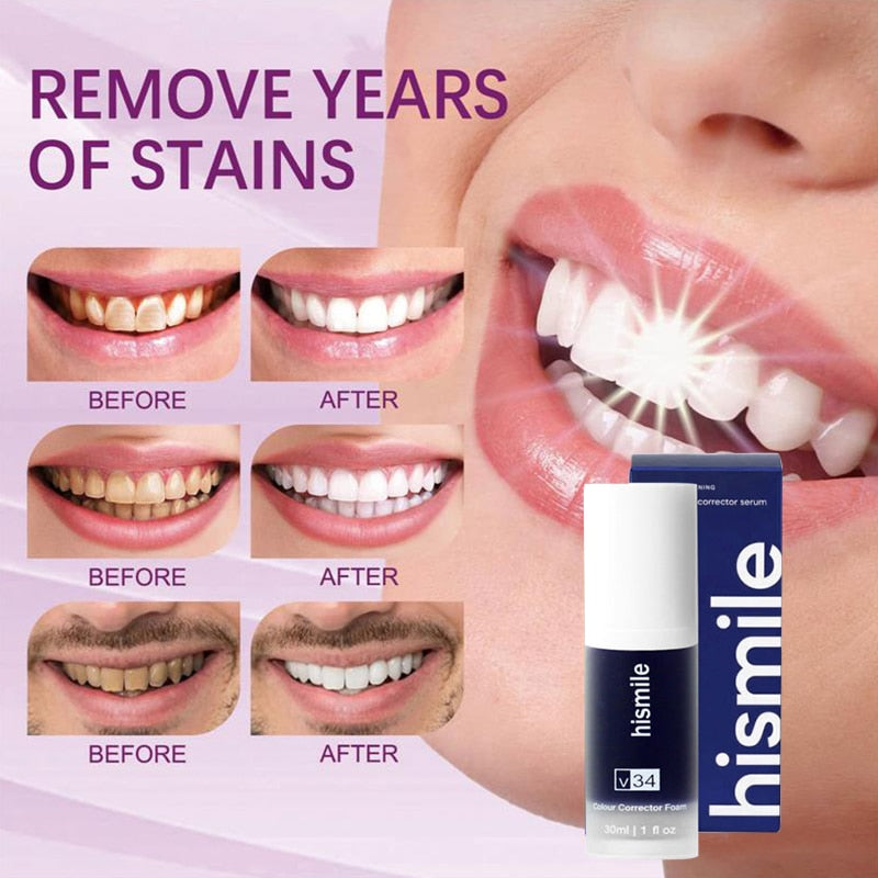 Hismile v34 Teeth Whitening Serum